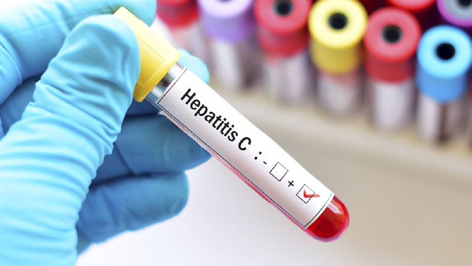 Nuevo caso sospechoso de hepatitis